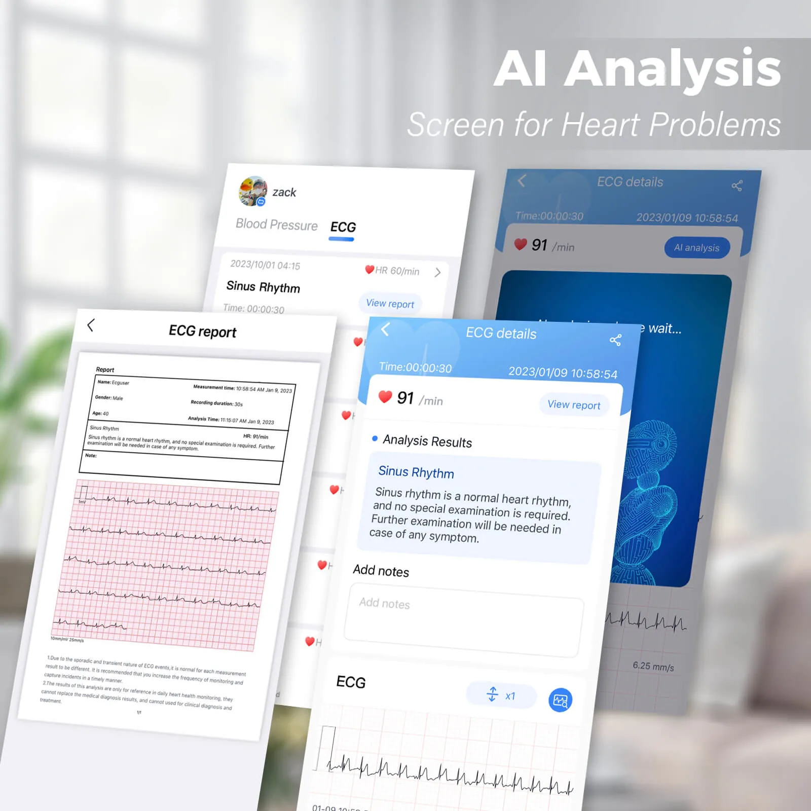 Wi-Fi Blood Pressure Monitor with ECG